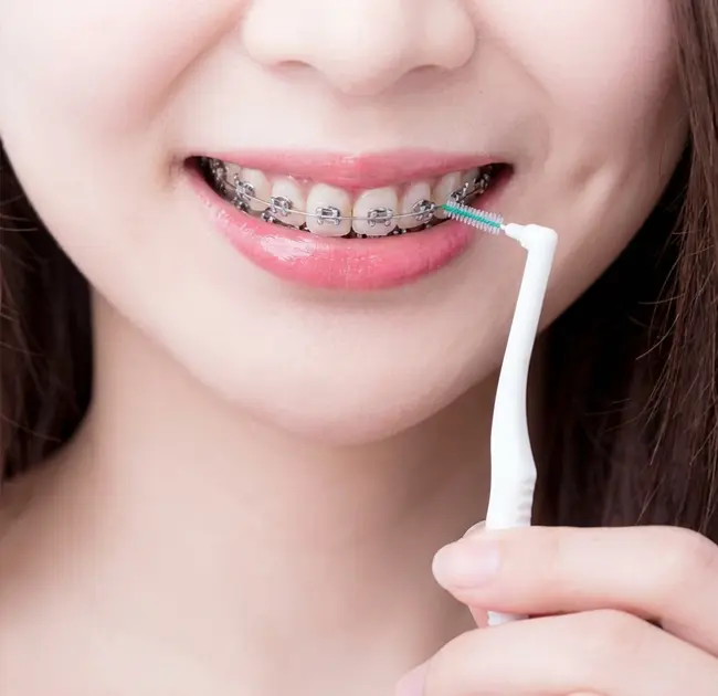 Interdental Brushes Novam Experientiam Expolitiore Oralis Tutela